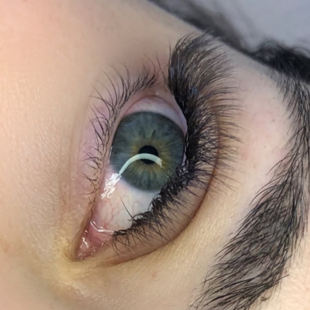 Resultado de cílios