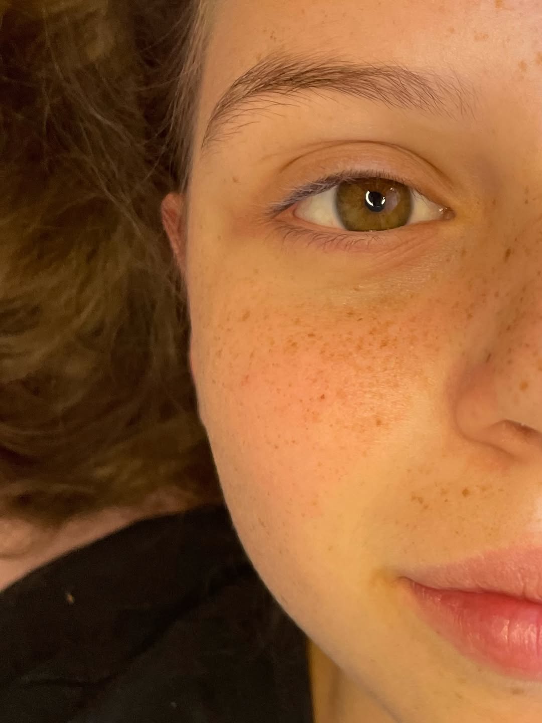 Antes do procedimento